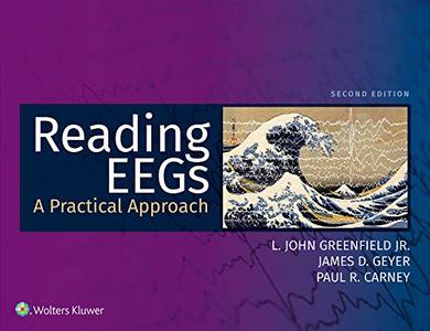 Reading EEGs A Practical Approach, 2nd Edition