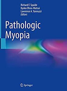 Pathologic Myopia 2nd Edition