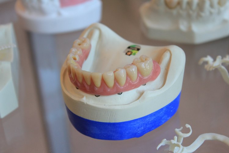 Заболевания зубов: виды болезней зубов и десен и их лечение