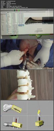 3D  for Medicine and Orthopedic Surgery 5830e52cabe4312dc1b9c7528a891ae6