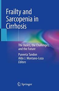 Frailty and Sarcopenia in Cirrhosis The Basics, the Challenges, and the Future