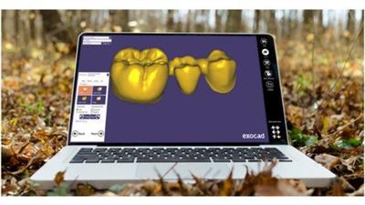 Digital  flow in dentistry and basic exocad program 1dc0ca61e6cd13dfcd1729e298a9dbee