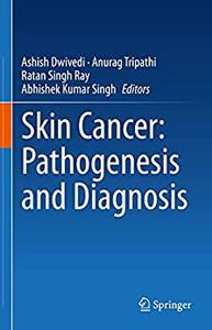 Skin Cancer Pathogenesis and Diagnosis