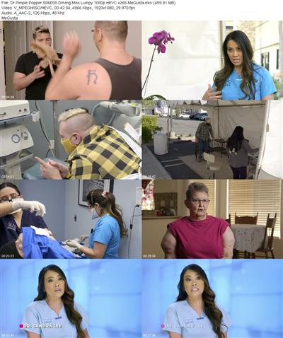 Dr Pimple Popper S06E05 Driving Miss Lumpy 1080p HEVC x265 