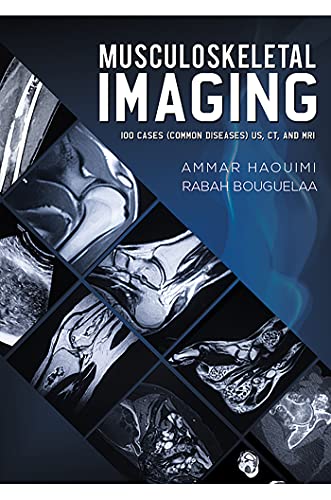 Musculoskeletal Imaging 100 Cases (Common Diseases) US, CT and MRI