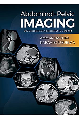 Abdominal Pelvic Imaging: 200 Cases (Common Diseases): US, CT and MRI