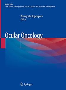 Ocular Oncology 