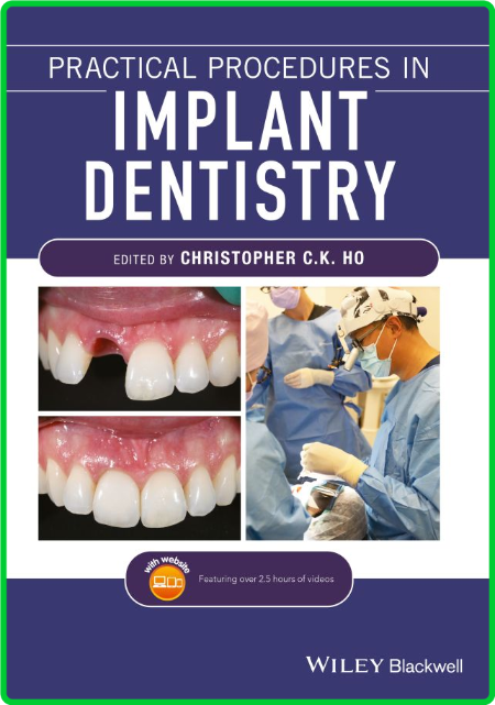 Practical Procedures in Implant Dentistry 0d0731c5f90ec60c1b937eba4ebfb5ff