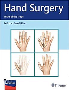 Hand Surgery Tricks of the Trade