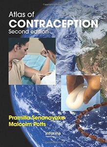 Atlas of Contraception, Second Edition (ENCYCLOPEDIA OF VISUAL MEDICINE SERIES)