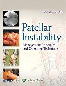Patellar Instability Management Principles and Operative Techniques