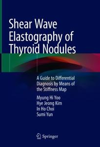 Shear Wave Elastography of Thyroid Nodules A Guide to Differential Diagnosis by Means of the Stiffness Map 