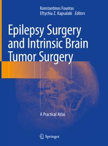Epilepsy Surgery and Intrinsic Brain Tumor Surgery A Practical Atlas