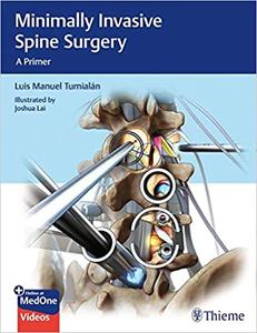 Minimally Invasive Spine Surgery A Primer