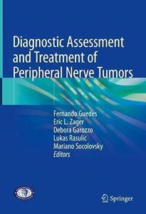 Diagnostic Assessment and Treatment of Peripheral Nerve Tumors