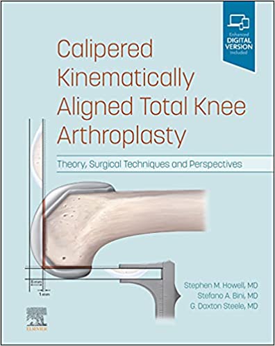 Calipered Kinematically Aligned Total Knee Arthroplasty E Book : Theory, Surgical Techniques and Perspectives