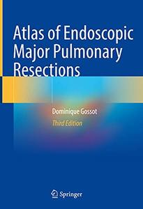 Atlas of Endoscopic Major Pulmonary Resections, 3rd Edition