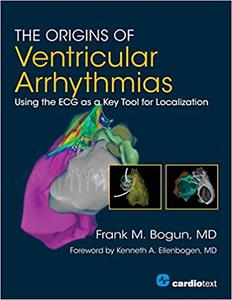 The Origins of Ventricular Arrythmias Using the ECG as a Key Tool for Localization