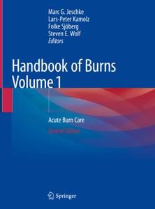 Handbook of Burns Volume 1 Acute Burn Care 
