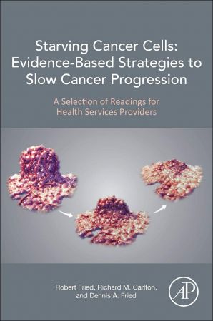 Starving Cancer Cells: Evidence Based Strategies to Slow Cancer Progression