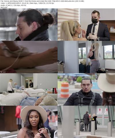 Darcey and Stacey S02E11 Over the Drama and Under the Knife 720p HEVC x265 