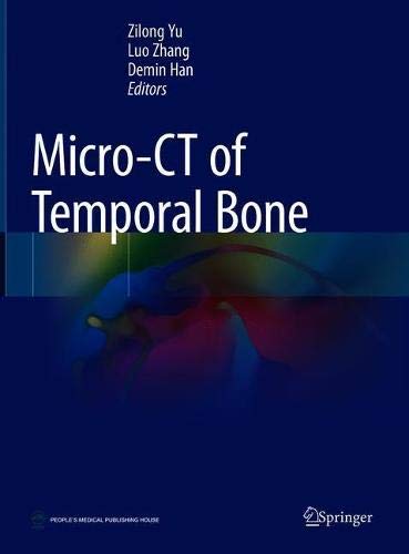 Micro CT of Temporal Bone