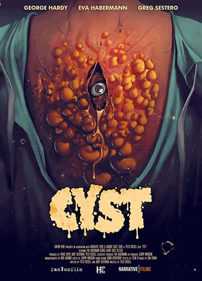 Cyst (2021) 720p WEBRip AAC2 0 X 264-EVO