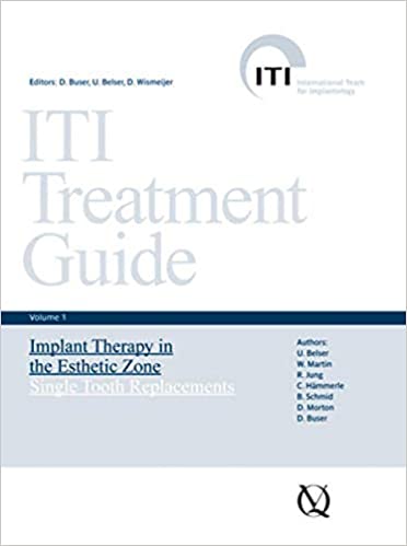 Iti Treatment Guide, Vol 1: Implant Therapy in the Esthetic Zone: Single Tooth Replacements