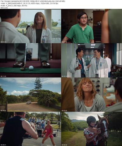 Doogie Kamealoha M D S01E05 1080p HEVC x265 