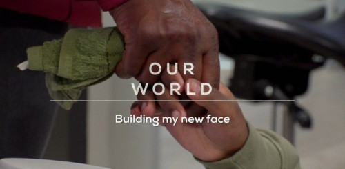 BBC Our World - Building My New Face (2021)